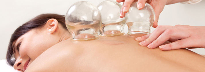 Chiropractic Irving TX Cupping