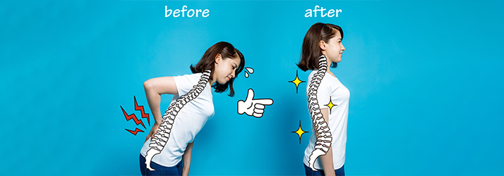 Chiropractic Irving TX Posture Analysis