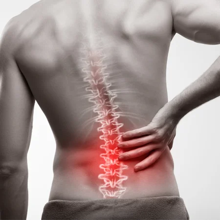 A drawing of a spine with inflammation superimposed on a photograph of a person's back