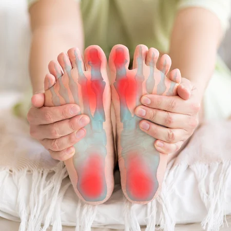 A rendering of foot bones superimposed on the bottom of a patient's feet with red indicating pain and inflammation